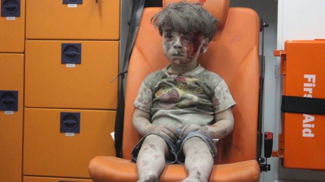 Halep'te Ümran Gibi 100 Binden Fazla Çocuk Var