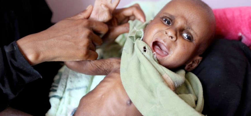 Yemen'de on binlerce çocuk açlıktan ölebilir