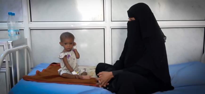 Yemen'de savaştan kaçan sivillerin kaldığı kamplarda salgın hastalık alarmı