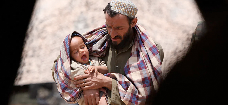 Afganistan'da yetersiz beslenme çocukları vuruyor